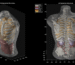 Midjourney Medical goes from AI image generation to full-body ultrasounds